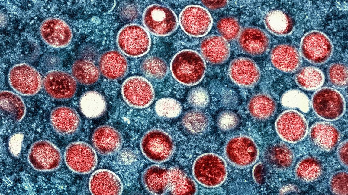 Diese Mikroskopaufnahme zeigt Mpox-Partikel in einer Zelle.