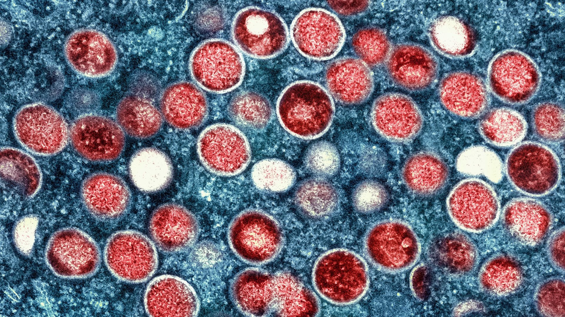 Diese Mikroskopaufnahme zeigt Mpox-Partikel in einer Zelle.