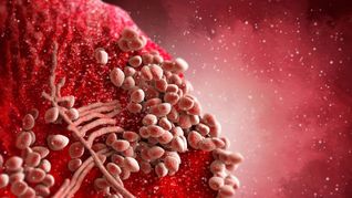 3D-Illustration vom Bakterium Staphylococcus aureus auf menschlicher Haut.