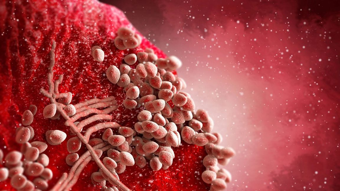 3D-Illustration vom Bakterium Staphylococcus aureus auf menschlicher Haut.