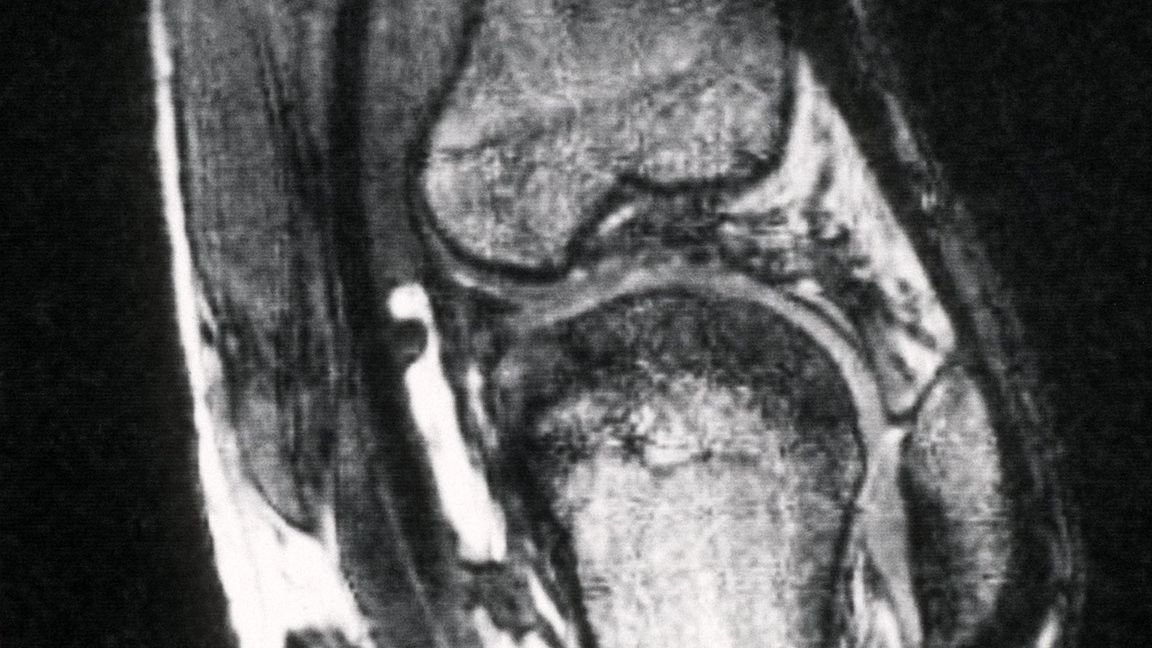 Schmerzen im Knie treiben viele Versicherte zum Orthopäden - viele kommen dort mit fragwürdigen Therapien in Kontakt. (Archivbild)