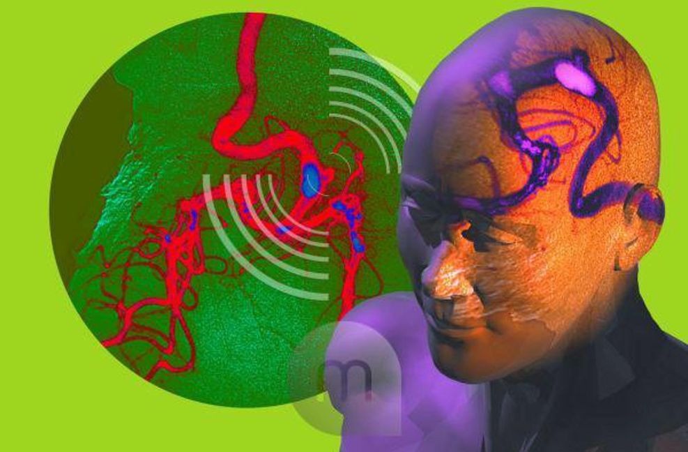 Das Gehirn wird über vier Arterien mit Blut versorgt.