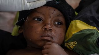 Ein besorgniserregendes Risiko sehen die beiden Experten für Übertragungen zwischen Kindern. (Archivbild)