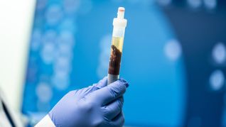 In Kalifornien konnte eine Pest-Infektion nachgewiesen werden