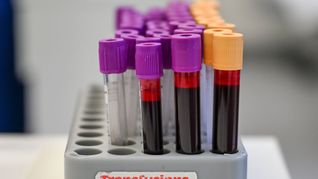 Eine Blutspende kann bis zu drei Menschen helfe (Symbolbild).