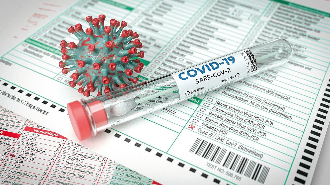 Neben den flächendeckenden Tests in den Pflegeheimen im Kreis Böblingen, wollen nun auch die Kliniken jeden ihrer Patienten auf das Coronavirus testen. Bild: MACLEG/Adobe Stock