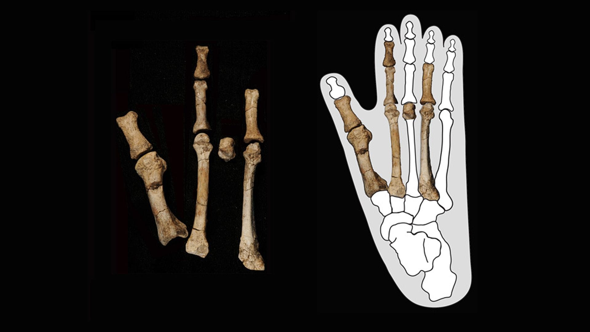 Diese 3,4 Millionen Jahre alten Knochen aus Äthiopien stammen vom Fuß eines Vormenschen. Aber von welchem? Das haben neue Fossilfunde nun geklärt.