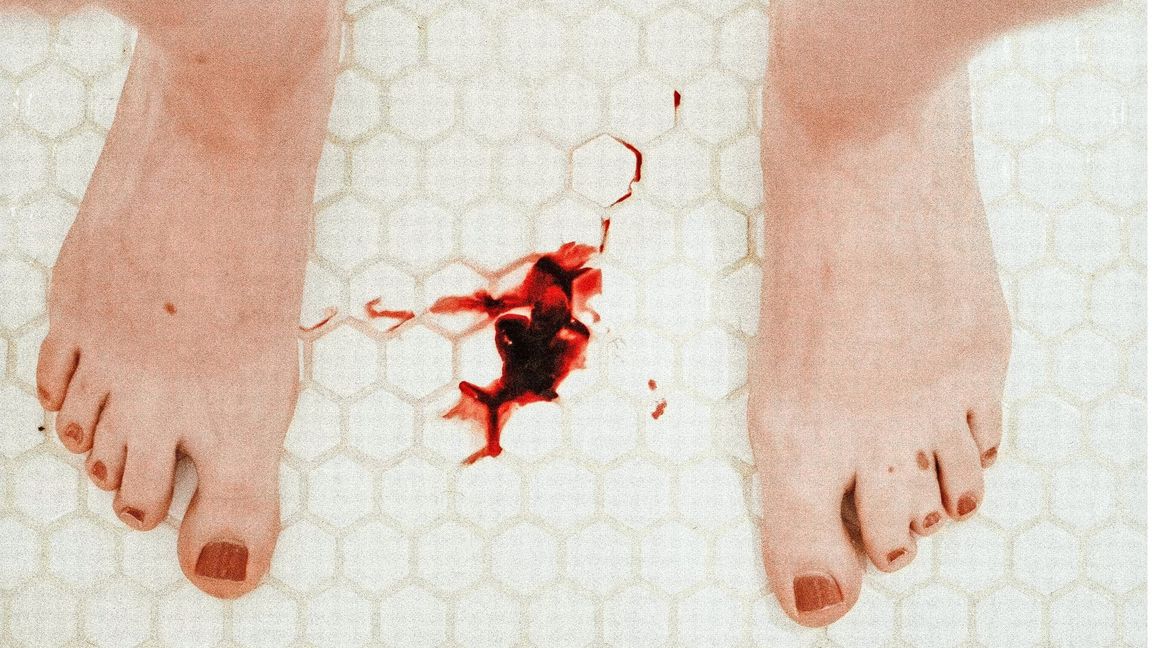 Die Periode der Frau war bis weit ins 20. Jahrhundert hinein ein Mittel, um Frauen auszugrenzen und als abnormal zu stigmatisieren.