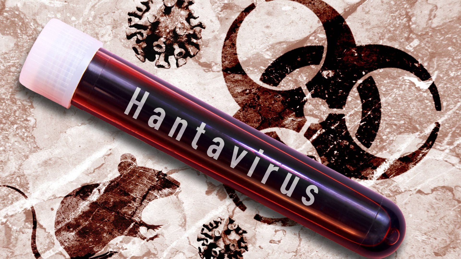 Hantavirus-Untersuchung im Labor (Montage/Symbolbild).