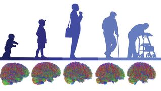 Im Laufe unseres Lebens durchläuft unsere Hirnstruktur fünf Phasen.
