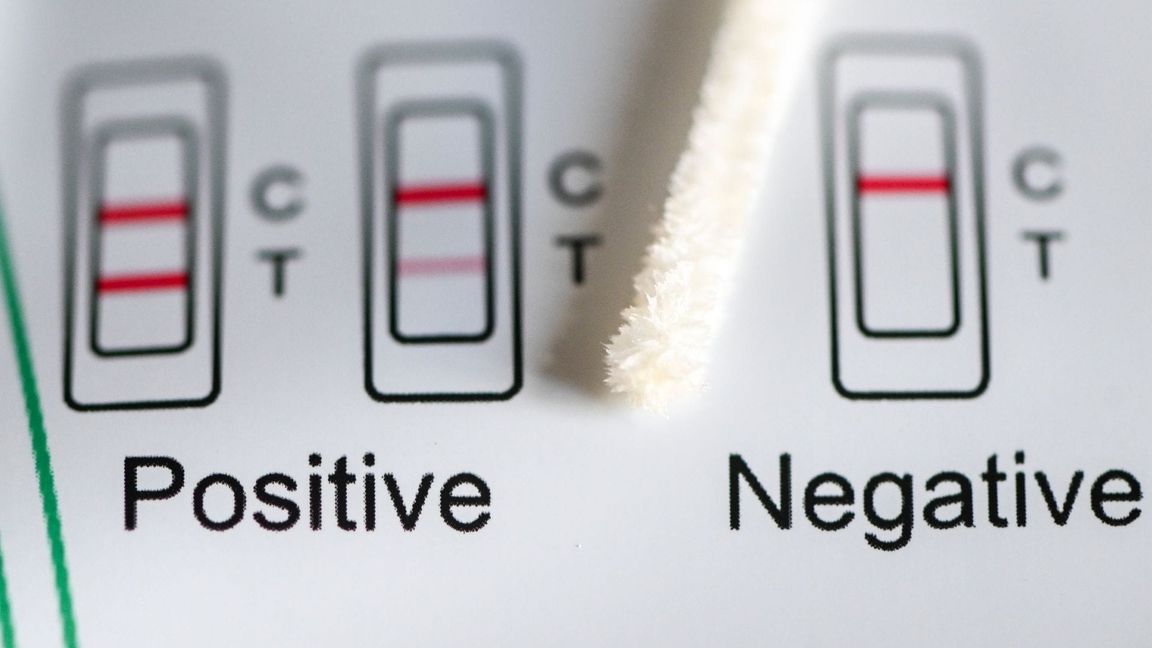 Positiv oder negativ - das zeigt ein Test an. (Symbolbild)
