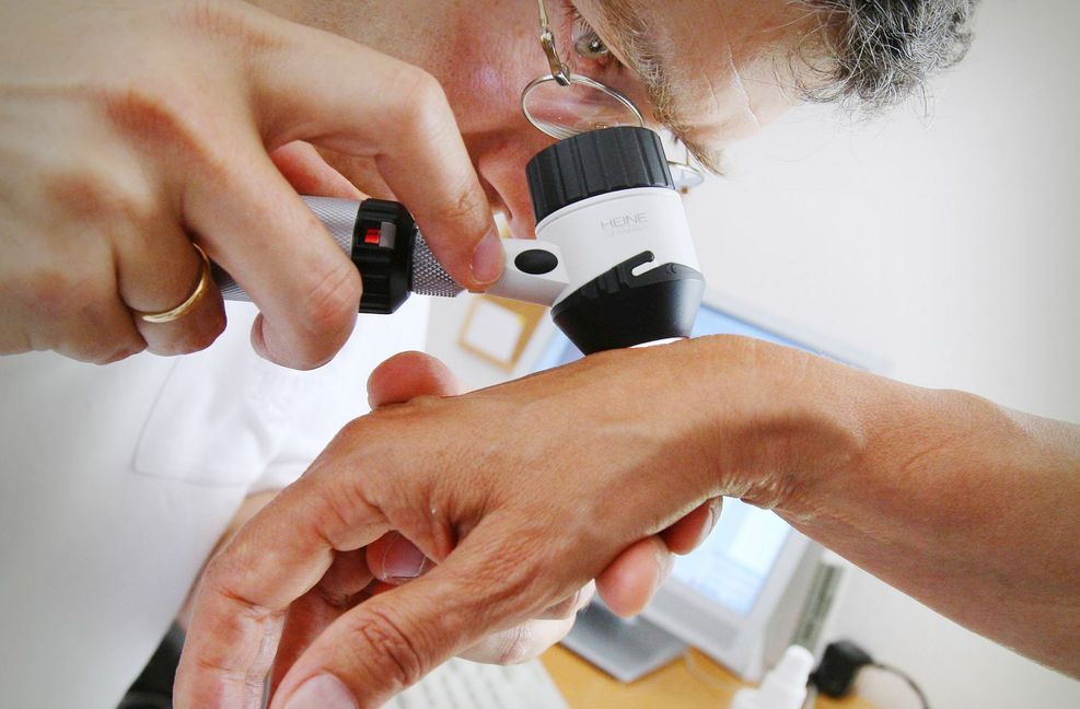 Gesetzlich Versicherte ab 35 Jahren haben alle zwei Jahre Anspruch auf Hautkrebs-Früherkennung (Screening). Die Google-App „Dermatology Assist“ soll künftig unterstützen.
Foto: dpa/Karl-Josef Hildenbrand