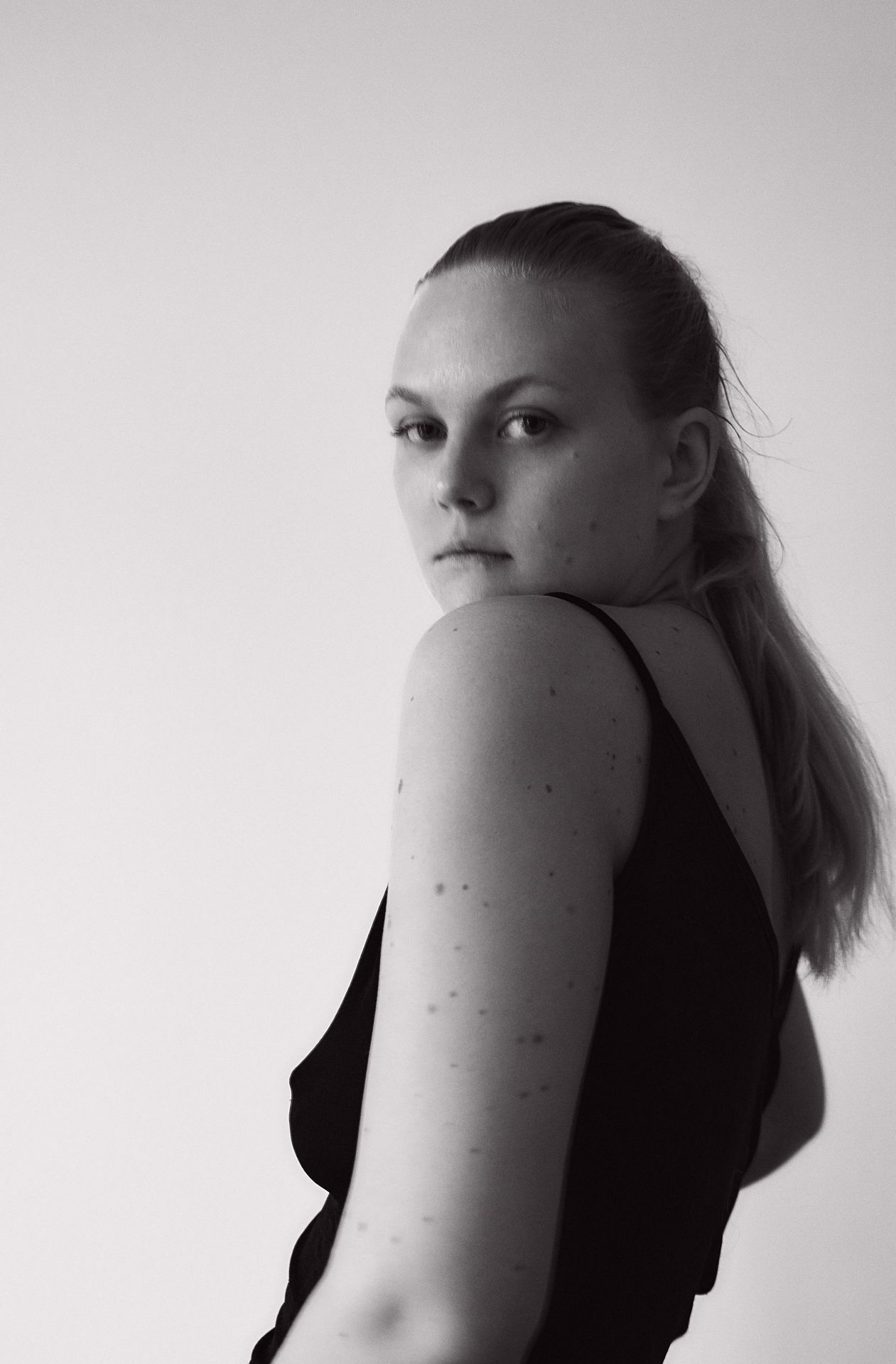 Heute ist die 32-Jährige zufrieden mit sich und ihrem Körper – und will ein Unternehmen gründen, das „nichts mit Modeln oder Mode zu tun hat“.