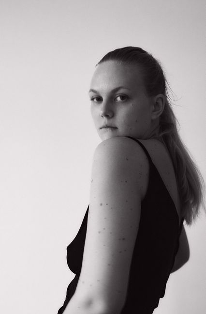 Heute ist die 32-Jährige zufrieden mit sich und ihrem Körper – und will ein Unternehmen gründen, das „nichts mit Modeln oder Mode zu tun hat“.
