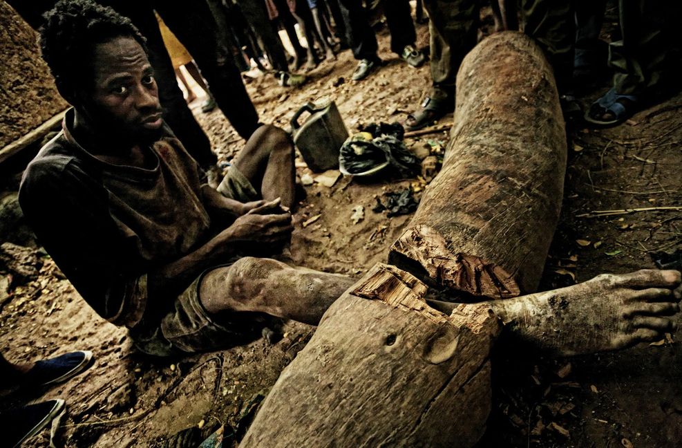 Benjamin wurde in seinem Dorf an einen Holzstamm fixiert mit einem Stück Eisen. Heute lebt er wieder bei seiner Familie.
Foto: Heinz Heiss