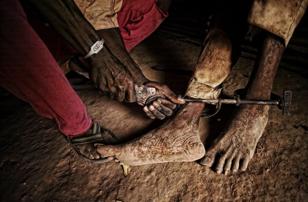 Andre Dembele ist aus der Fußfessel befreit worden, wurde lange Zeit im Zentrum in Bouake betreut und konnte wieder in sein Dorf zurück.