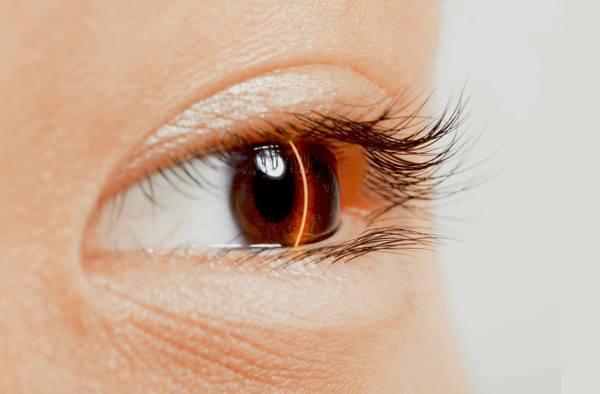 Viele Menschen lassen sich die Augen lasern, um eine  Hornhautkrümmung zu korrigieren. Damit wird  eine  Brille oft überflüssig.